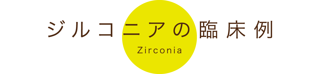 ジルコニアの臨床例