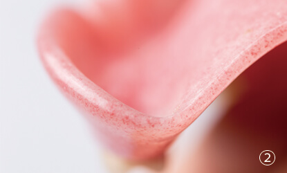 一般的な入れ歯の素材の断面