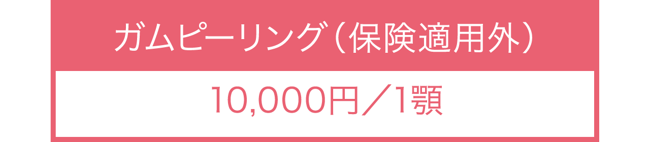 ガムピーリングの料金