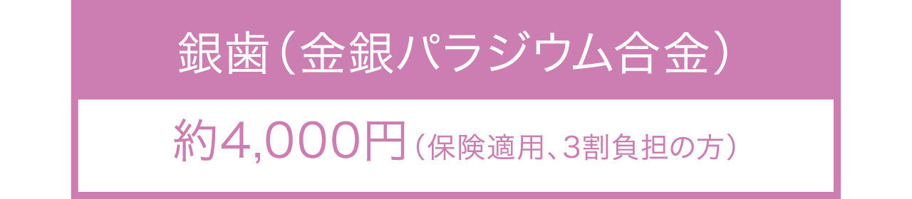 銀歯（金銀パラジウム合金）のかぶせ物料金