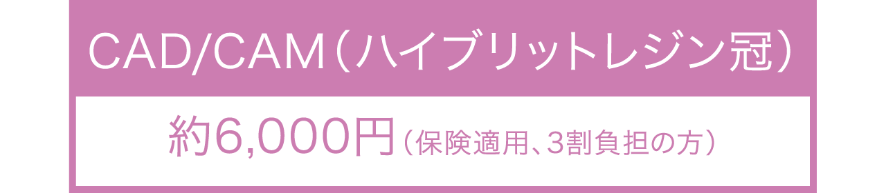 CAD/CAM（ハイブリットレジン冠）のかぶせ物料金